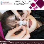 چسب زدن بینی- دکتر امراله حسینی - doctor-hosseini.com