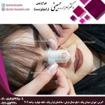 چسب زدن بینی- دکتر امرالله حسینی - doctor-hosseini.com