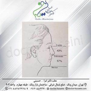 جراحی زیبایی چانه- دکتر حسینی - doctor-hosseini.com