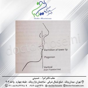 جراحی زیبایی چانه- دکتر امراله حسینی -doctor-hosseini.com